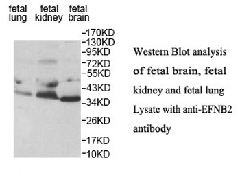 EFNB2 Rabbit Polyclonal Antibody