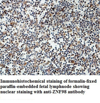 ZNF98 Rabbit Polyclonal Antibody