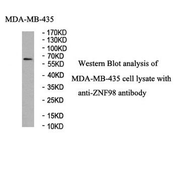 ZNF98 Rabbit Polyclonal Antibody