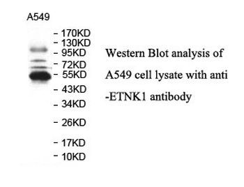 ETNK1 Rabbit Polyclonal Antibody
