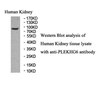 PLEKHG6 Rabbit Polyclonal Antibody