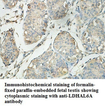 LDHAL6A Rabbit Polyclonal Antibody