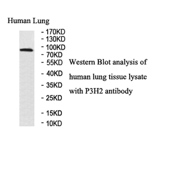 LEPREL1 Rabbit Polyclonal Antibody