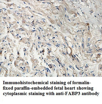 FABP3 Rabbit Polyclonal Antibody