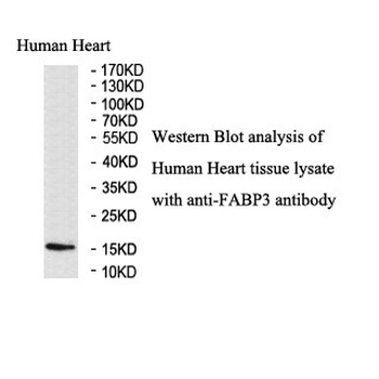 FABP3 Rabbit Polyclonal Antibody