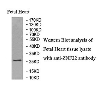 ZNF22 Rabbit Polyclonal Antibody