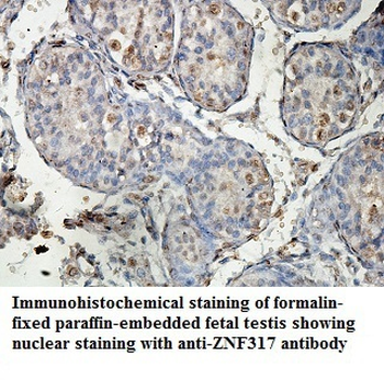 ZNF317 Rabbit Polyclonal Antibody