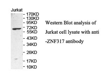 ZNF317 Rabbit Polyclonal Antibody