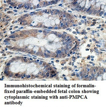 PMPCA Rabbit Polyclonal Antibody