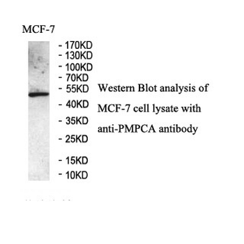 PMPCA Rabbit Polyclonal Antibody