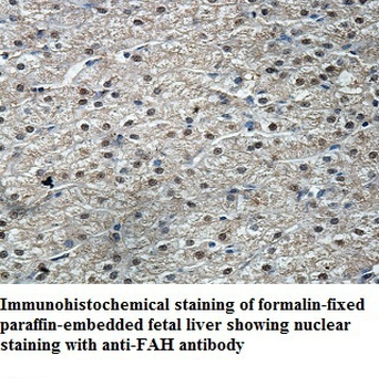FAH Rabbit Polyclonal Antibody