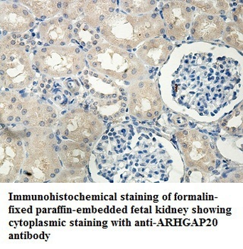 ARHGAP20 Rabbit Polyclonal Antibody