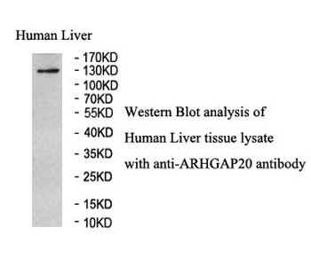 ARHGAP20 Rabbit Polyclonal Antibody