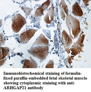 ARHGAP21 Rabbit Polyclonal Antibody
