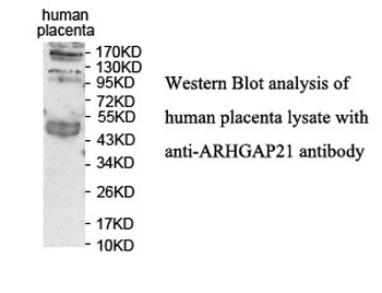ARHGAP21 Rabbit Polyclonal Antibody