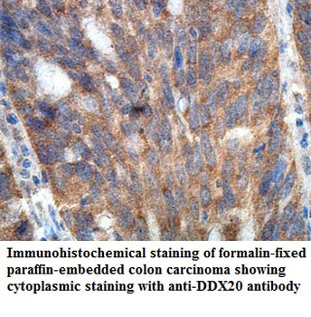 DDX20 Rabbit Polyclonal Antibody