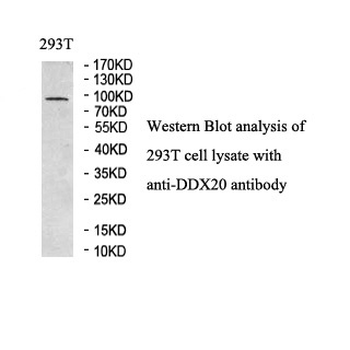 DDX20 Rabbit Polyclonal Antibody