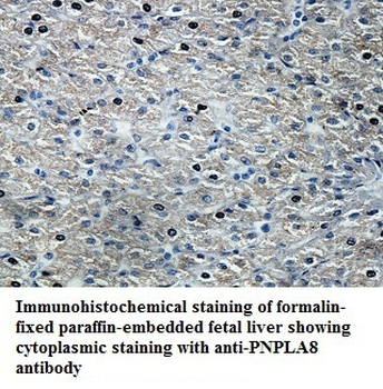 PNPLA8 Rabbit Polyclonal Antibody
