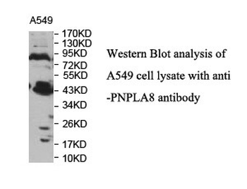 PNPLA8 Rabbit Polyclonal Antibody