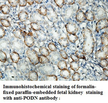 PODN Rabbit Polyclonal Antibody