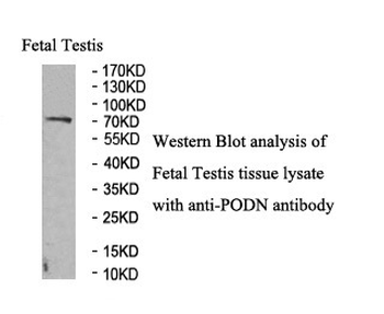 PODN Rabbit Polyclonal Antibody