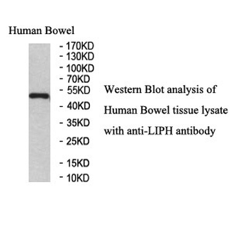 LIPH Rabbit Polyclonal Antibody