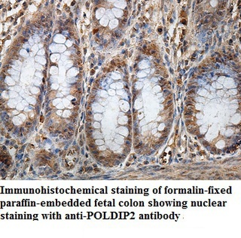 POLDIP2 Rabbit Polyclonal Antibody