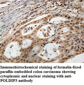 POLDIP3 Rabbit Polyclonal Antibody