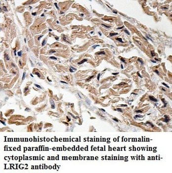 LRIG2 Rabbit Polyclonal Antibody