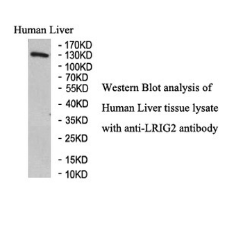 LRIG2 Rabbit Polyclonal Antibody