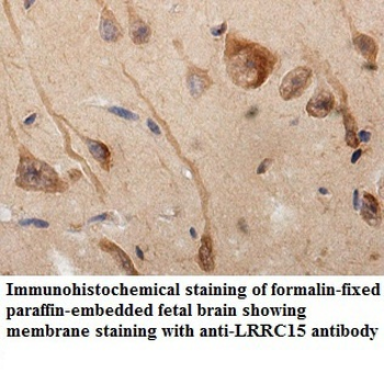 LRRC15 Rabbit Polyclonal Antibody