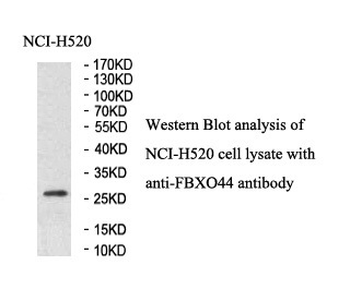 FBXO44 Rabbit Polyclonal Antibody