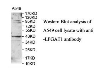 LPGAT1 Rabbit Polyclonal Antibody