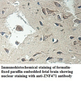 ZNF471 Rabbit Polyclonal Antibody