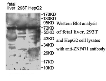 ZNF471 Rabbit Polyclonal Antibody