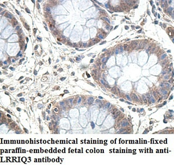 LRRIQ3 Rabbit Polyclonal Antibody