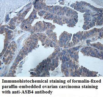 ASB4 Rabbit Polyclonal Antibody