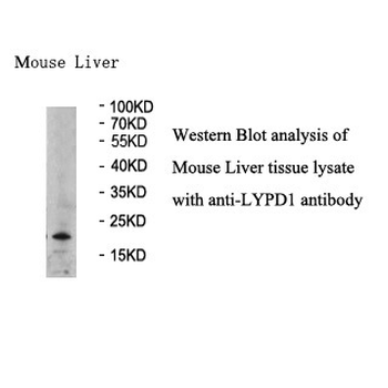 LYPD1 Rabbit Polyclonal Antibody