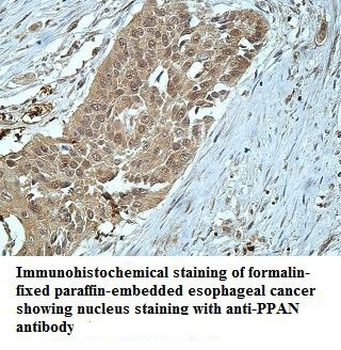 PPAN Rabbit Polyclonal Antibody