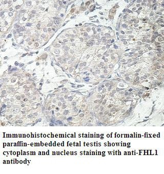 FHL1 Rabbit Polyclonal Antibody