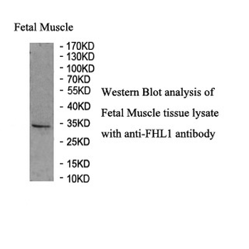 FHL1 Rabbit Polyclonal Antibody
