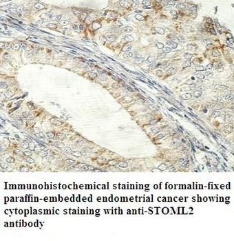 STOML2 Rabbit Polyclonal Antibody