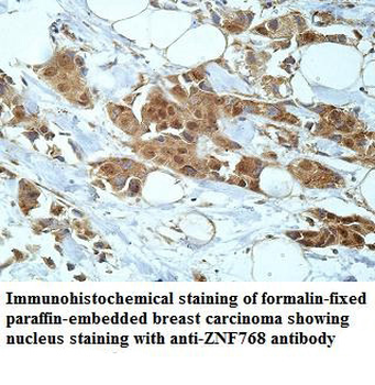 ZNF768 Rabbit Polyclonal Antibody