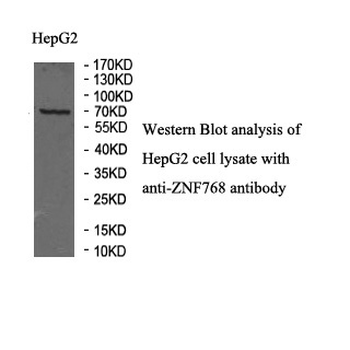 ZNF768 Rabbit Polyclonal Antibody