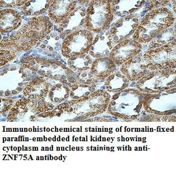 ZNF75A Rabbit Polyclonal Antibody