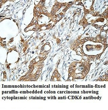 CDK6 Rabbit Polyclonal Antibody