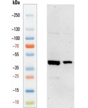 Guinea pig anti-Tubulin beta 3 Antibody