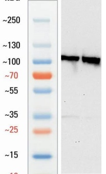 Goat anti-CDH1 Antibody