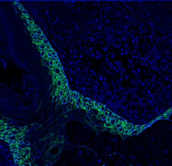 Goat anti-CK5 Antibody