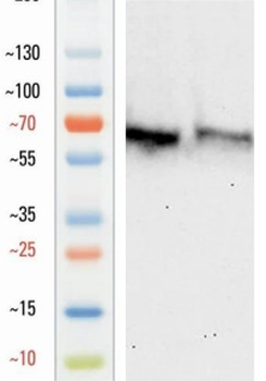 Goat anti-CK5 Antibody